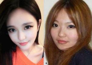 爆料小猪整容视频大全图片,视频大全与图片大曝光